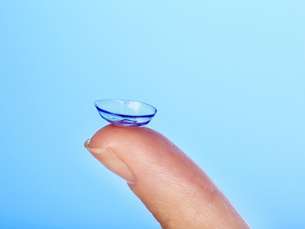 Kontaktlinsen Trockene Augen als Folge?