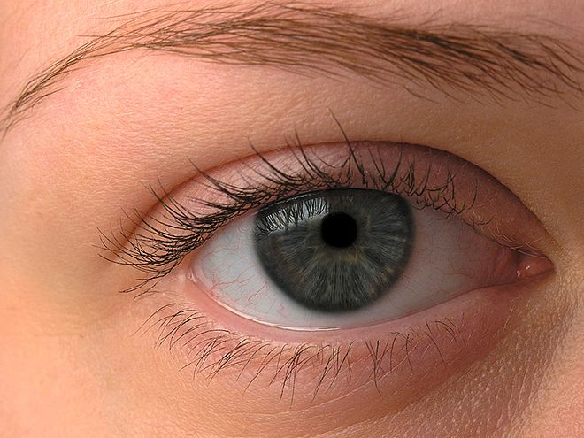 Auge Tut Weh Beim Schließen Lidrandentzündung (Blepharitis): Behandlung, Symptome