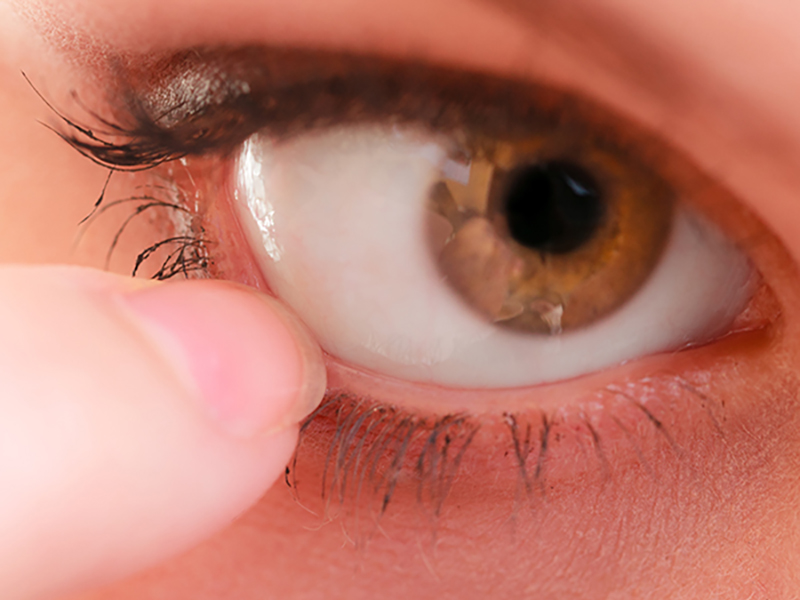Augensalbe wird zwischen Innenseite des Unterlides und Auge eingestrichen.
